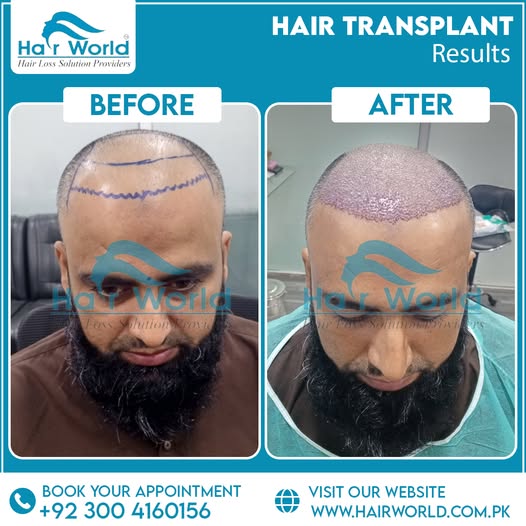 515356193_1349032080564016_5854423721730582874_n