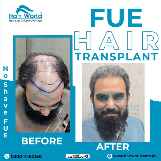 518469238_1340417171425507_551045802621552871_n