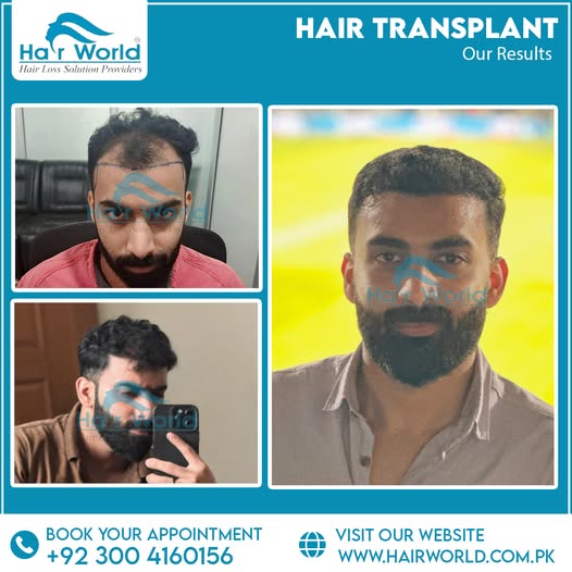 549026314_1393647809435776_2736926690652786596_n