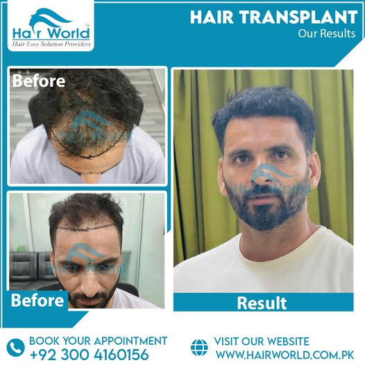 555617460_1403090278491529_2081967511315233813_n