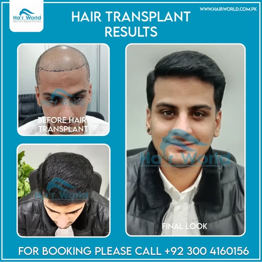 611635922_1495781439222412_2447952227605411542_n